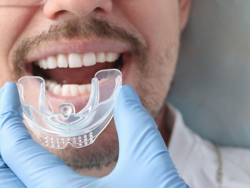 dental braces of men