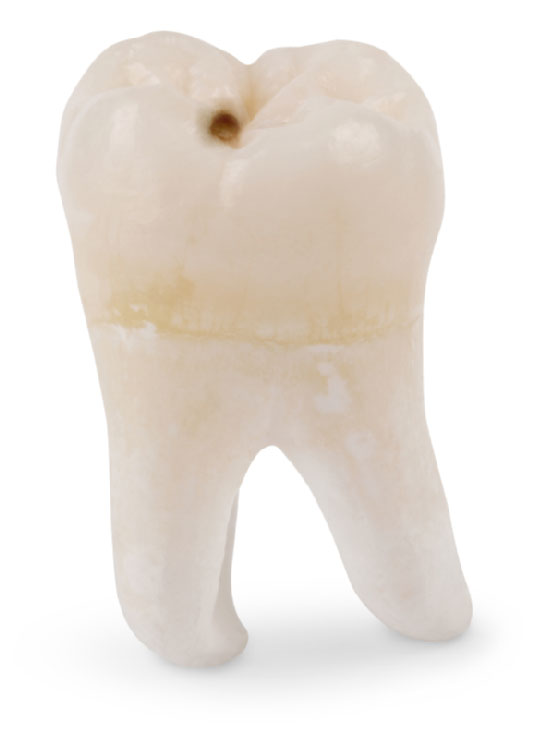 Featured image for “Your Guide to Dental Fillings”