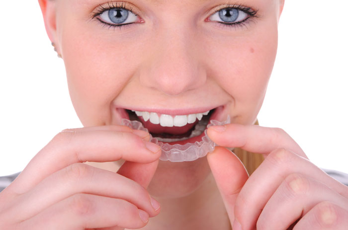 A women applying Invisalign