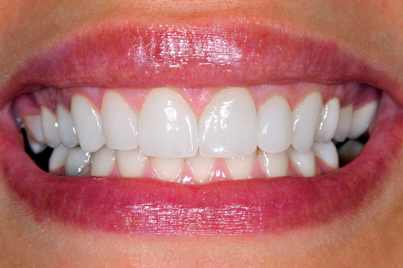 Featured image for “Periodontal Disease Treatment in Sanford”