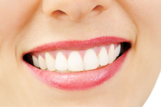 Featured image for “Reasons to Consider Professional Teeth Whitening Over At-Home Whitening Methods”