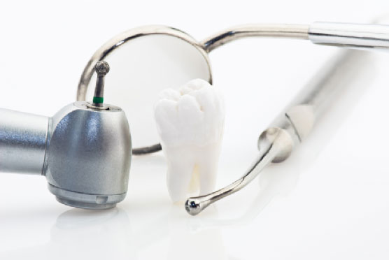 Dental implants