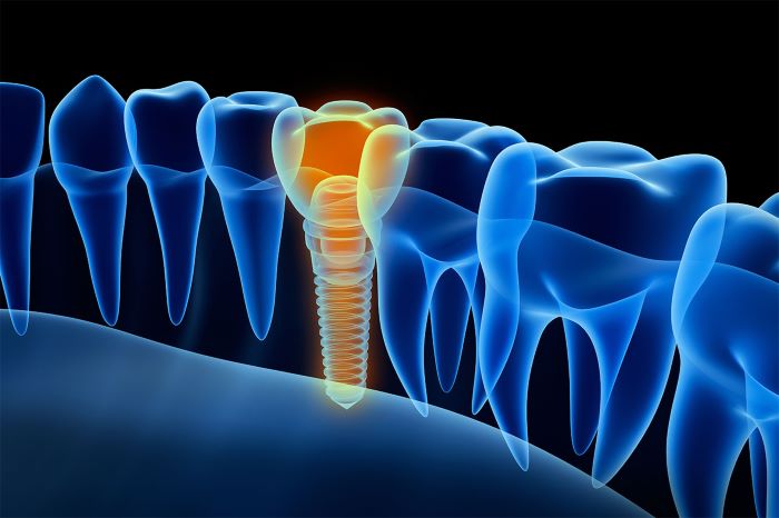 dental X-ray