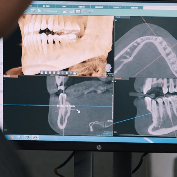 patient's teeth and jaw x-rays