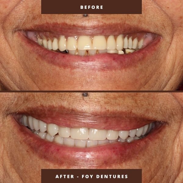 fountain of youth dentures orlando